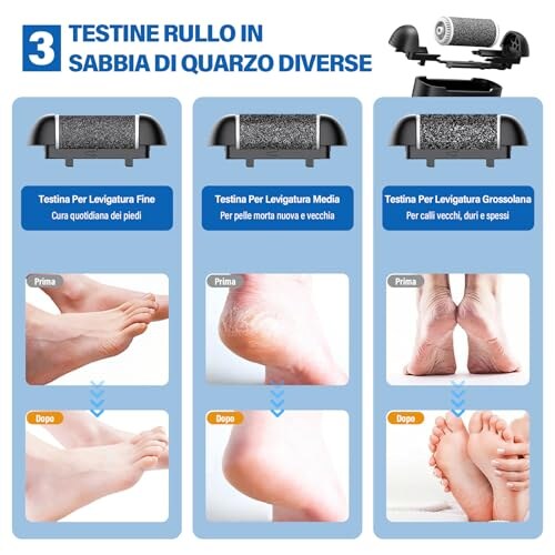 Ehomfory Pedicure Elettrico Ricaricabile con 3 Rulli - immagine 3
