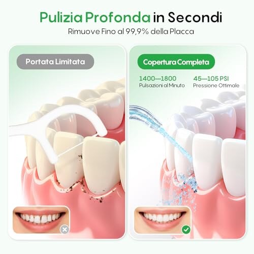 FRESKO Idropulsore Dentale Portatile 300ML - immagine 1