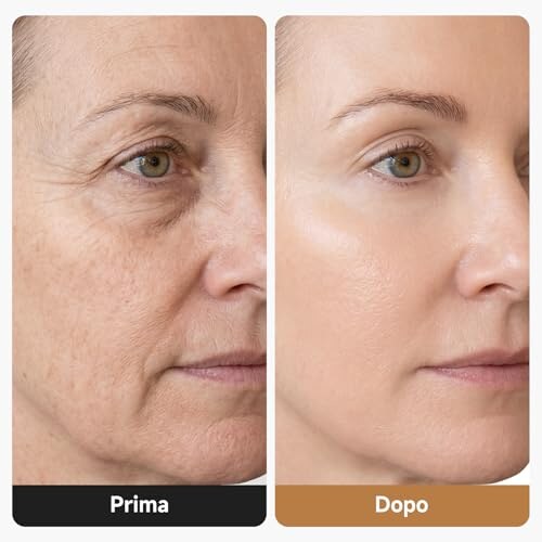 Hoakya Massaggiatore Viso Elettrico Lifting - immagine 1