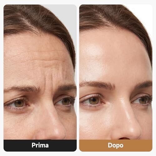 Hoakya Massaggiatore Viso Elettrico Lifting - immagine 2