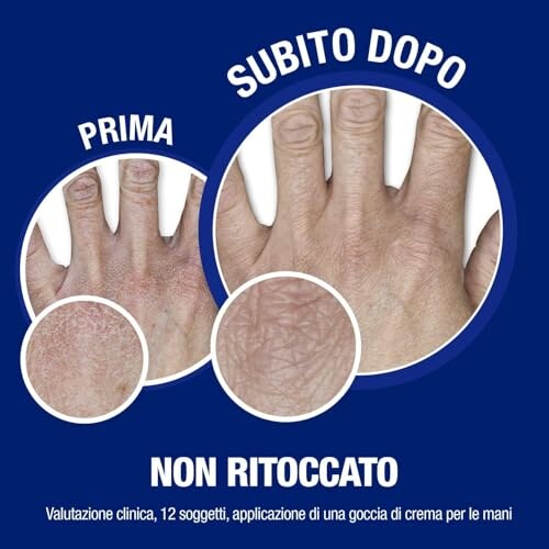Neutrogena Crema Mani Riparatrice 150ml - immagine 3