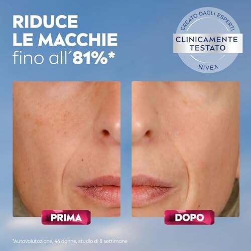 NIVEA Luminous630 Siero Viso Anti-Età e Anti-Macchie - immagine 3