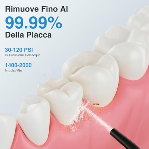 SURFOU Idropulsore Dentale Portatile Elettrico - immagine 6