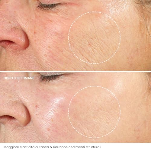 Crema Viso Antirughe Acido ialuronico - immagine 4