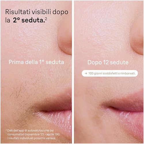 Braun Silk·expert Pro 5 Epilatore Luce Pulsata - immagine 2