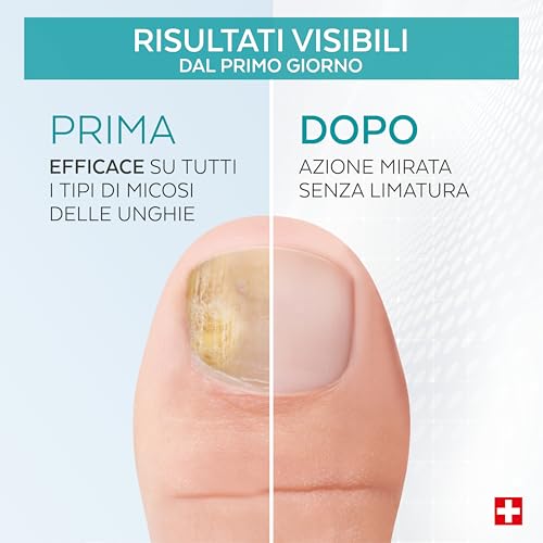 Poderm Trattamento Micosi Unghie 2 in 1 - immagine 2